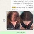 سرم سیر سیاه لاکچری کوین | افزایش ضخامت و استحکام تارهای مو