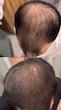 سرم سیر سیاه لاکچری کوین | افزایش ضخامت و استحکام تارهای مو