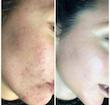 کرم و ژل ضد جوش بیوممتیک 