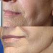 کرم ضد چروک گاتیو ۵ کاره و بوتاکس کننده | Gatieau Anti-Wrinkle Face Cream