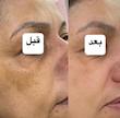 روشن کننده بیوممتیک حاوی ویتامین سی گاتیو