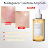 آمپول(سرم) سنتلا ماداگاسکار SKIN1004 آبرسان و ترمیم کننده