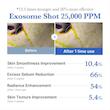شات ضدجوش Medicube مدی کیوب Exosome 25000