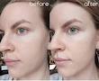 آمپول کوچک‌کننده و کنترل‌کننده منافذ سنتلا SKIN1004 (اسکین 1004) مدل Madagascar Poremizing Fresh Ampoule ماداگاسکار مناسب پوست چرب و مختلط حجم 100 میل
