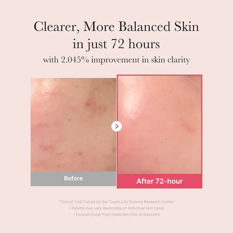سرم ضدلک و روشن‌کننده مدی کیوب مدل TXA + Niacinamide 15% Serum (Medicube TXA + Niacinamide 15% Serum)