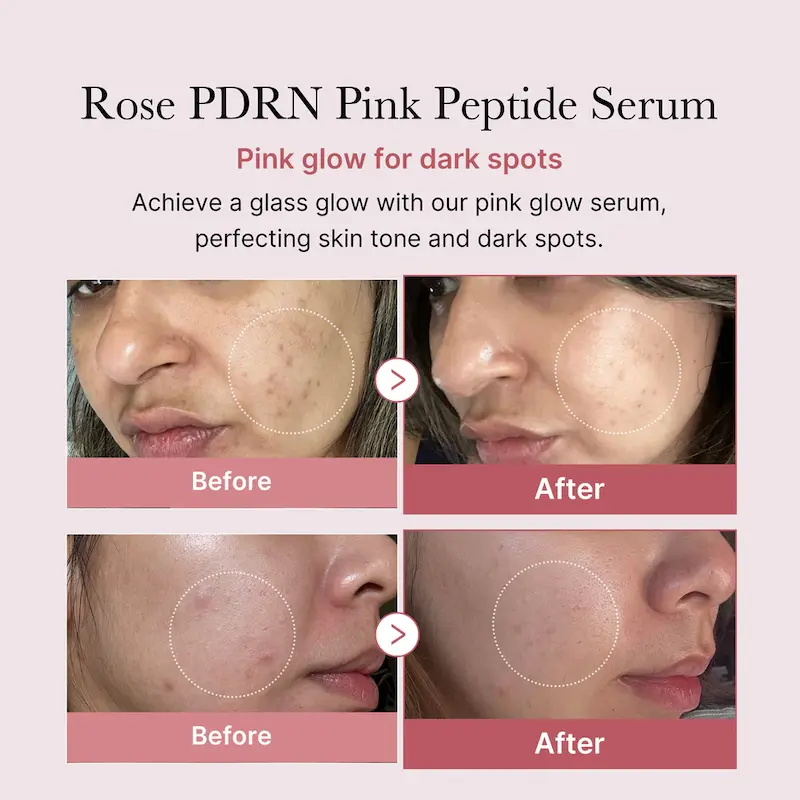 سرم روشن‌کننده و بازسازی‌کننده Medicube مدی کیوب مدل PDRN Pink Peptide Serum حاوی پپتاید و PDRN مناسب ترمیم و شفاف‌سازی پوست حجم 30 میل