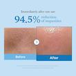 شوینده ژلی روغنی صورت مدی کیوب Medicube مدل Zero Pore Blackhead مناسب پوست چرب و مستعد جوش حجم 205 میل