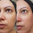 اسنس متعادل کننده رنگ پوست کوزارکس گالاکتومایسس 