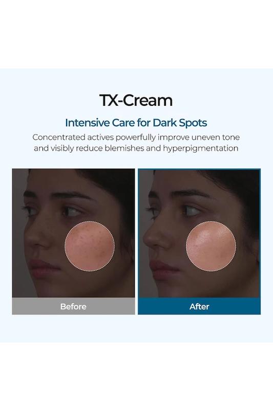 کرم ضدلک و روشن کننده ترانگزامیک اسید + نیاسینامید TX ( Tranexamic Acid ) Cream دکتر ملاکسین