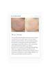 کرم ضد لک و روشن کننده ترانگزامیک اسید + نیاسینامید TX ( Tranexamic Acid ) Cream دکتر ملاکسین