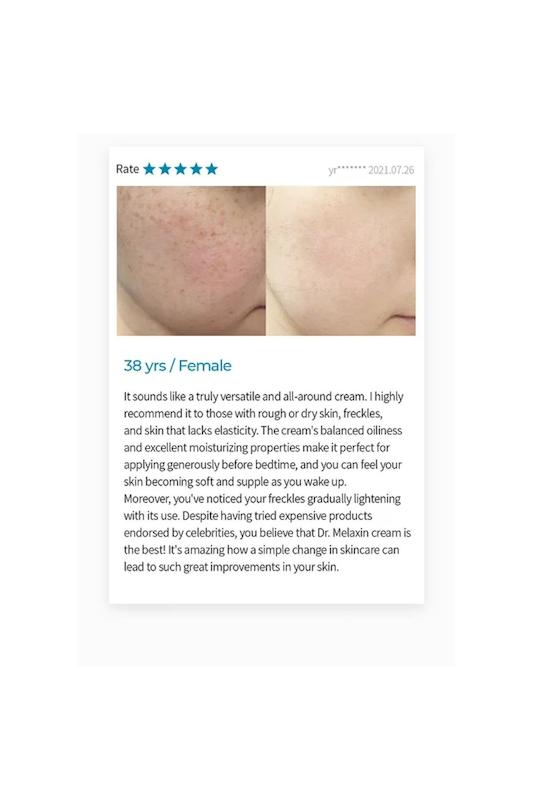 کرم ضدلک و روشن کننده ترانگزامیک اسید + نیاسینامید TX ( Tranexamic Acid ) Cream دکتر ملاکسین