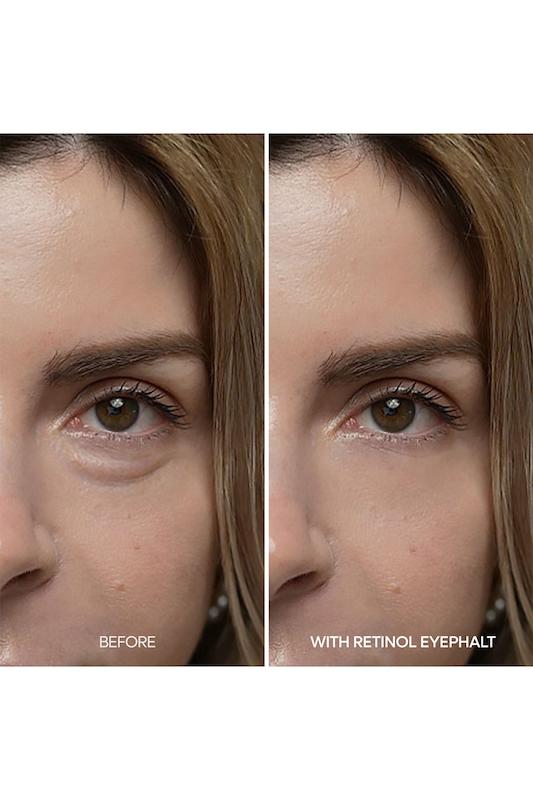 کرم دور چشم رتینول و کلاژن ایفالت دکتر ملاکسین Eyephalt Retinol Eyebag Cream 