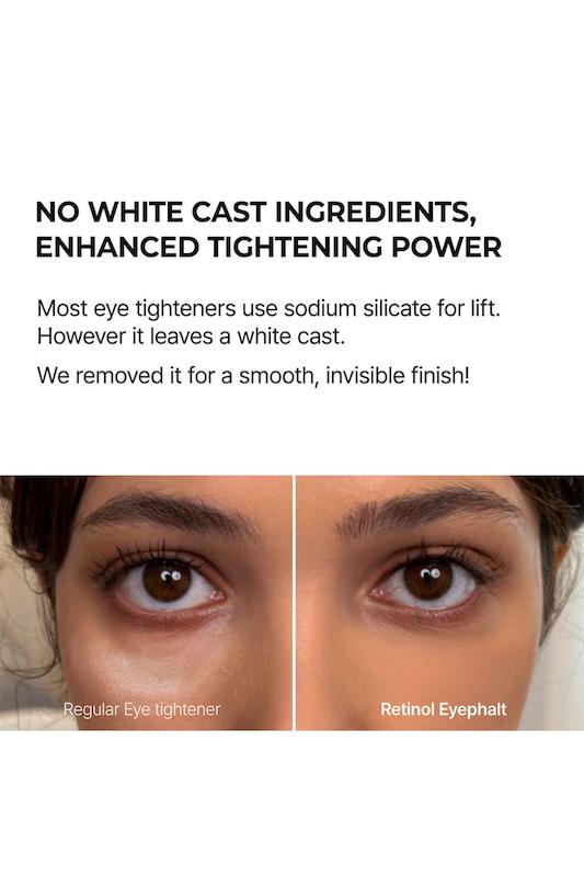 کرم دور چشم رتینول و کلاژن ایفالت دکتر ملاکسین Eyephalt Retinol Eyebag Cream 