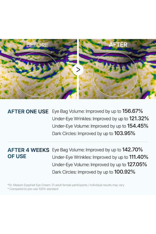 کرم دور چشم ضد چروک روشن کننده دکتر ملاکسین Eyebag cream 