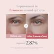 کرم دور چشم ضدچروک و روشن‌کننده Medicube مدی کیوب PDRN Pink Peptide Eye Cream مناسب کاهش تیرگی و خطوط دور چشم