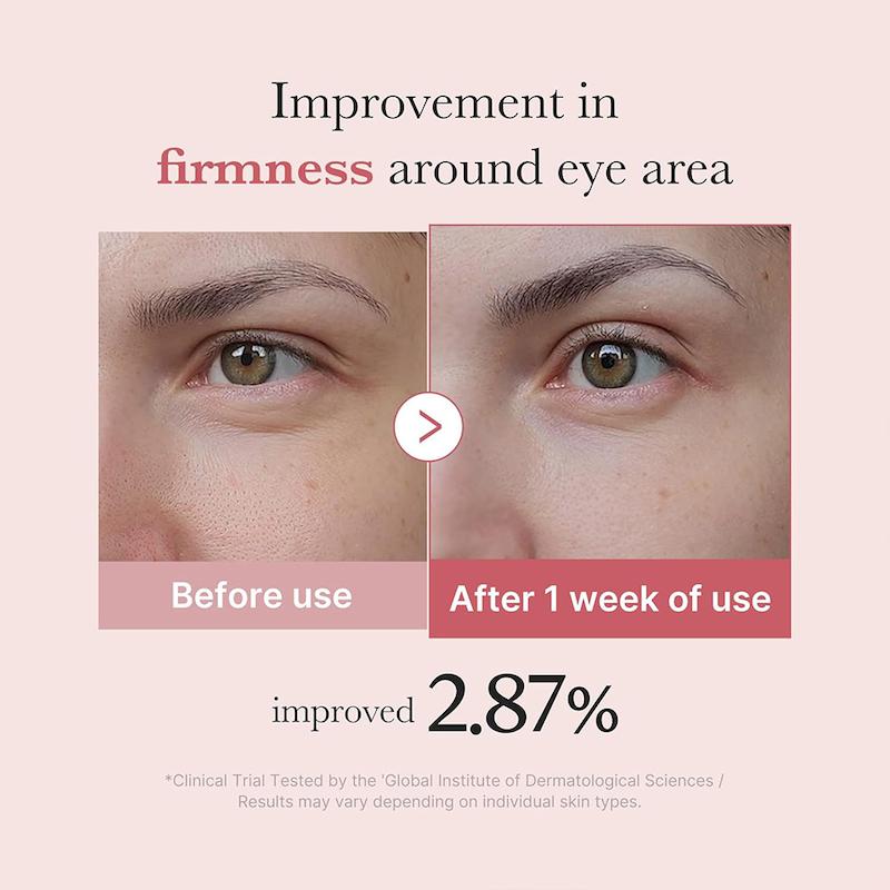 کرم دور چشم ضدچروک و روشن‌کننده Medicube مدی کیوب PDRN Pink Peptide Eye Cream مناسب کاهش تیرگی و خطوط دور چشم