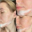 شوینده فومی صورت سراوی مناسب پوست نرمال و چرب حجم 236 میلی لیتر
