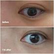 کرم دور چشم دبل ضد تیرگی و ضد چروک قوی دکتر ملاکسین Dr.Melaxin TX Tranexamic Acid Retinalsome Dual Eye Cream