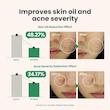  سرم ضد لک و ضد جوش اکسیس وای Axis Y Spot The Difference Blemish Treatment 15Ml