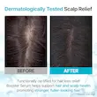 سرم تقویت‌کننده و احیاکننده پوست سر گروس Recover Therapy Booster Serum حجم 15 میل