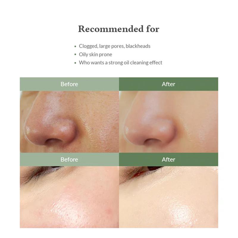 پاک کننده و کنترل چربی سبوم دکتر آلتیا (Premium Quick step sebum cleanser Dr althea)