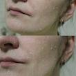 ژل پیلینگ شکوفه زردآلو بیوتی اف جوسان Beauty of joseon apricot blossom peeling gel