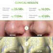 پک ماسک بینی 3 مرحله کاکتوس دکتر ملاکسین DR.MELAXIN CACTOX 3-Step Nose Mask Pack