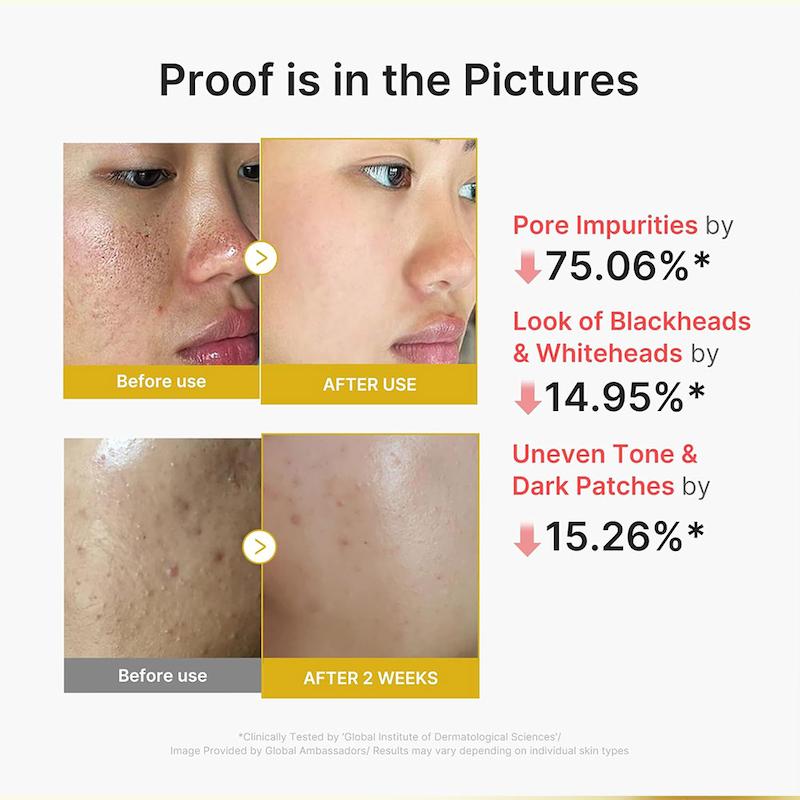 سرم پیل شات کوجیک اسید و زردچوبه مدی کیوب لایه بردار ملایم و روشن کننده پوست MEDICUBE Kojic Acid & Turmeric Peel Shot Serum