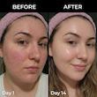 مولتی بالم مدی کیوب PDRN حجم دهنده و لیفتینگ MEDICUBE PDRN Volume & Lifting Multi Balm