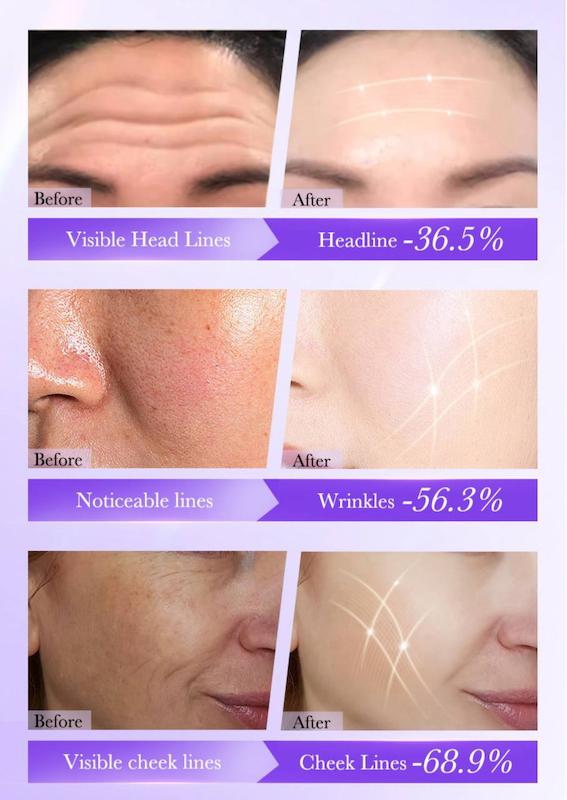 سرم رتینول bioaqua (ضد چروک و کوچک کننده منافذ)