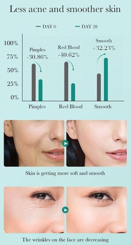 سرم هیالورونیک اسید bioaqua 