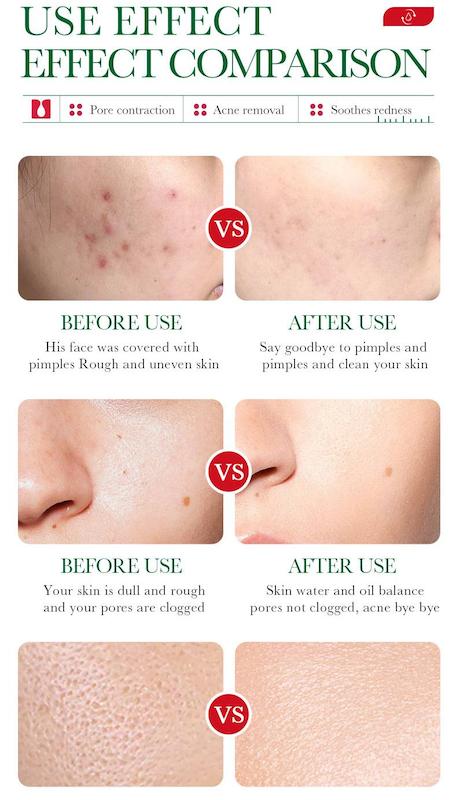 اسنس سالیسیایک اسید BIOAQUA