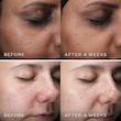 سرم روشن کننده پپتاید ، نیاسینامید مدیک8 سایز 30ML