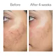 سرم تقویت کننده بریر اینکی لیست 30ML