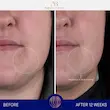 کرم مرطوب کننده لوکس اگوستینوس بادر 15ML