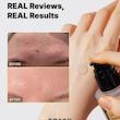 اسنس حلزون کوزارکس (COSRX) مدل Advanced Snail 96 Mucin – حجم ۱۰۰ میل