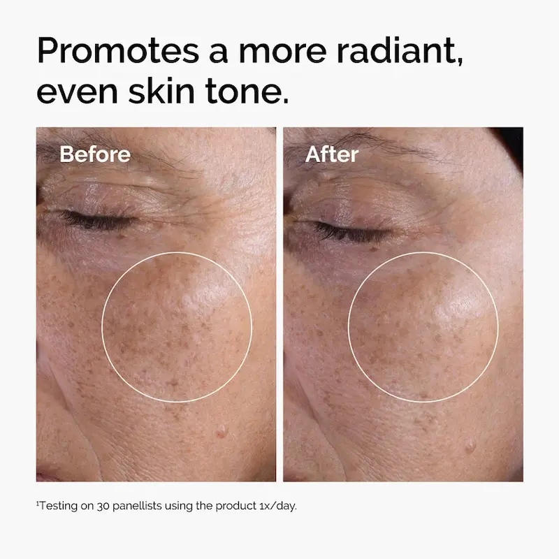 تونر گلیکولیک اسید %7 اوردینری Ordinary Glycolic Acid Toner🍋