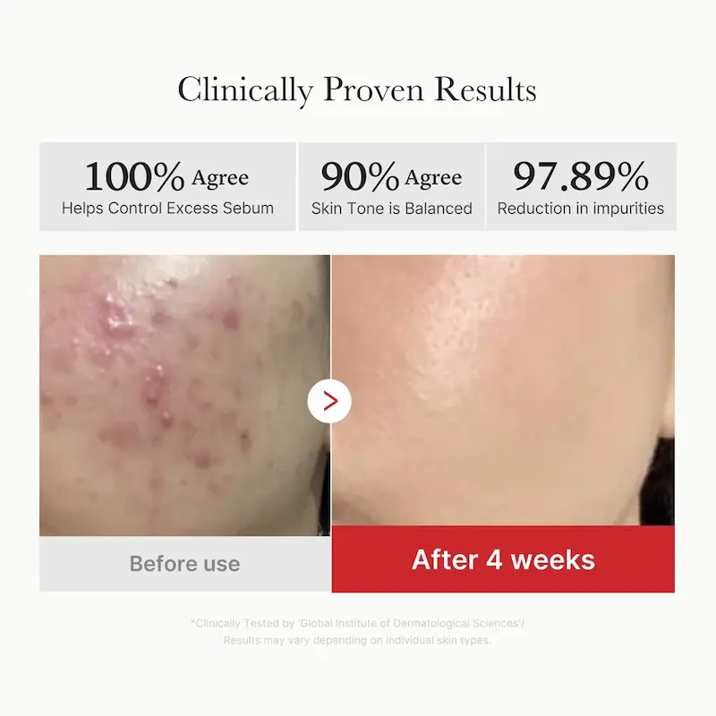 پدهای پانتنول اسید سوکسینیک قرمز Red Succinic Acid Panthenol Pads