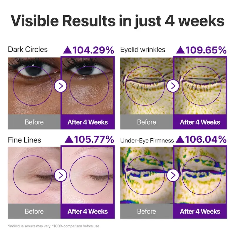 کرم دور چشم رتینول ولومتوکس نامبوزین  Numbuzin NAD+ Retinol Volumetox Eye Cream