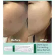 سرم ضد لک و روشن کننده Dark Spot حجم ۵۰ میل اکسیس وای