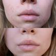 کرم ترمیم‌ کننده سیکاپلاست B5+ لاروش پوزای La Roche-Posay Cicaplast Baume +B5