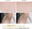 اسپری لایه‌بردار و روشن‌کننده دکتر ملاکسین مدل Peel Shot حجم 200 میل | Dr. Melaxin Peel Shot Exfoliating & Brightening Spray 200ml