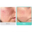 سرم آزلائیک اسید 16% مدیکیوب ✨ | Medicube Azelaic Acid 16 Serum