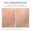 کرم بوستر شات دور چشم و صورت ترانگزامیک اسید TXA آرنسیا 🪞|Arencia TXA Booster Shot Serum