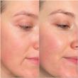 تونر لایه بردار و روشن کننده گلایکولیک اسید اورجینال اوردینری✨️| 7%  The Ordinary Glycolic Acid 7% Toning Solution 240ml