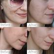 سرم ضد لک و روشن کننده آلفا آربوتین ۲% + هیالورونیک اسید اوردینری✨️|The Ordinary Alpha Arbutin 2% + HA