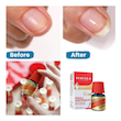 سرم سفت کننده و تقویت کننده ناخن شکننده ماوالا💅| Mavala Nail Hardner Serum