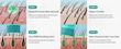 سرم ضد ریزش مو کف سر حاوی سیکا لیلیوئه💙lilyeve - Scalp Turn Cica PDRN Brush Ampoule