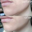 تونر لایه بردار و ترمیم کننده سنتلا ماداگاسکار اسکین 1004 ۲۱۰ میل💛|  SKIN1004 Madagascar Centella Toning Toner
