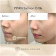 ژل بوستر ضد چروک و جوانساز PDRN مدی کیوب💗| Medicube PDRN Booster Gel